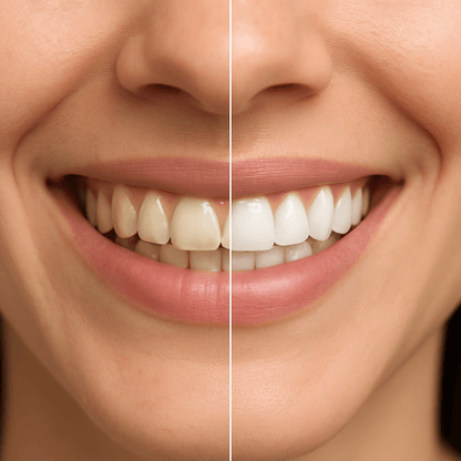 TryLumzy - Teeth Whitening Pen